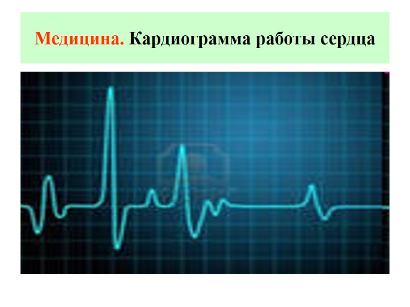 Медицина. Кардиограмма работы сердца